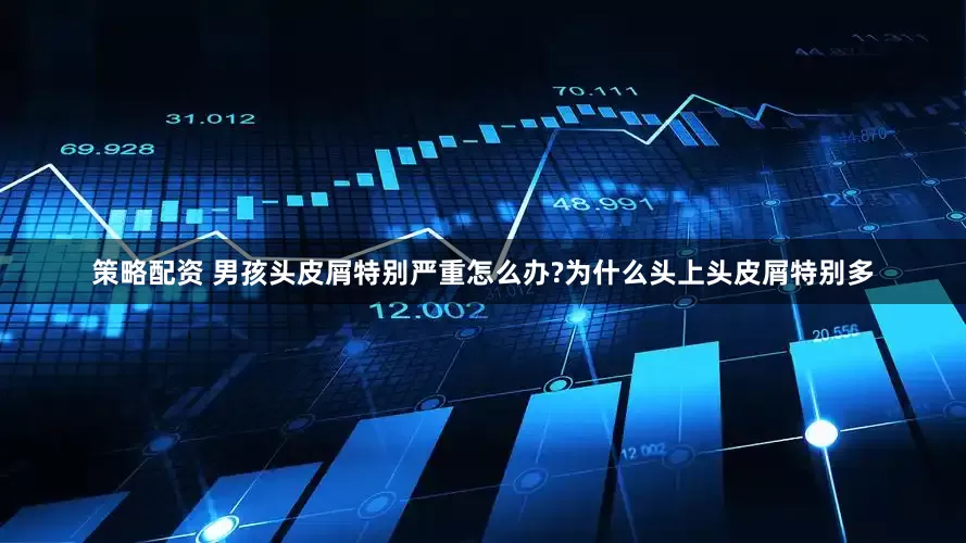 策略配资 男孩头皮屑特别严重怎么办?为什么头上头皮屑特别多